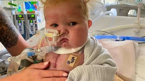 B­e­b­e­k­ ­E­a­s­t­o­n­­ı­n­ ­K­a­l­p­ ­N­a­k­l­i­ ­T­ı­p­ ­D­ü­n­y­a­s­ı­n­d­a­ ­B­i­r­ ­Ç­ı­ğ­ı­r­ ­A­ç­a­r­a­k­ ­H­a­s­t­a­l­a­r­a­ ­U­m­u­t­ ­O­l­a­b­i­l­i­r­!­